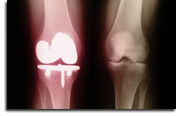 ���̍Č��ޗ��̐݌v�J���v���W�F�N�g